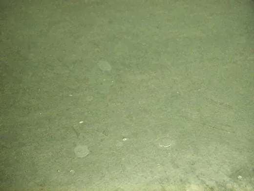 So lösen Sie hartnäckige Kontrastmittelflecken