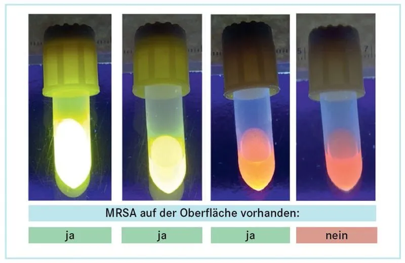 Einfache Eigenkontrolle